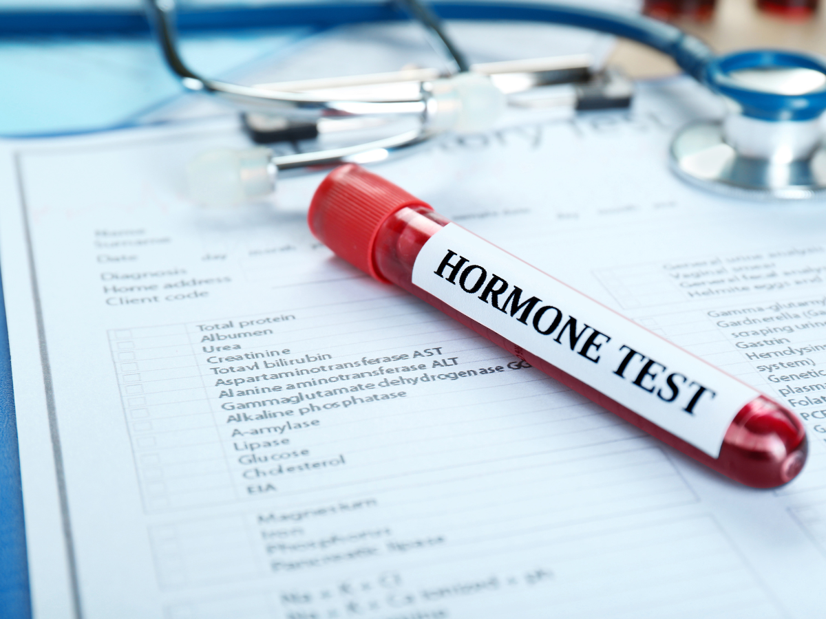 Entenda os exames hormonais mais comuns pedidos por endocrinologistas
